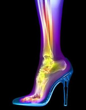 Stiletto duele